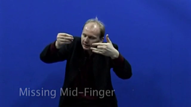 Missing Mid-Finger